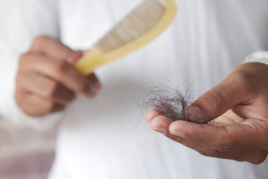 Efluvio telógeno: caída del pelo